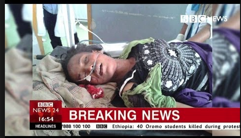 A victim of government massacre in Ambo, Ethiopia