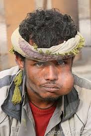 A qat addict in Yemen